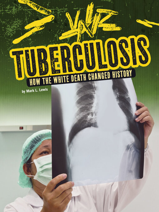 Title details for Tuberculosis by Mark K. Lewis - Wait list